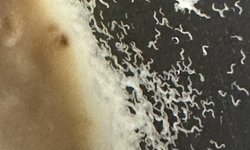 Microworm culture